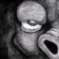 Les Porcs en concert